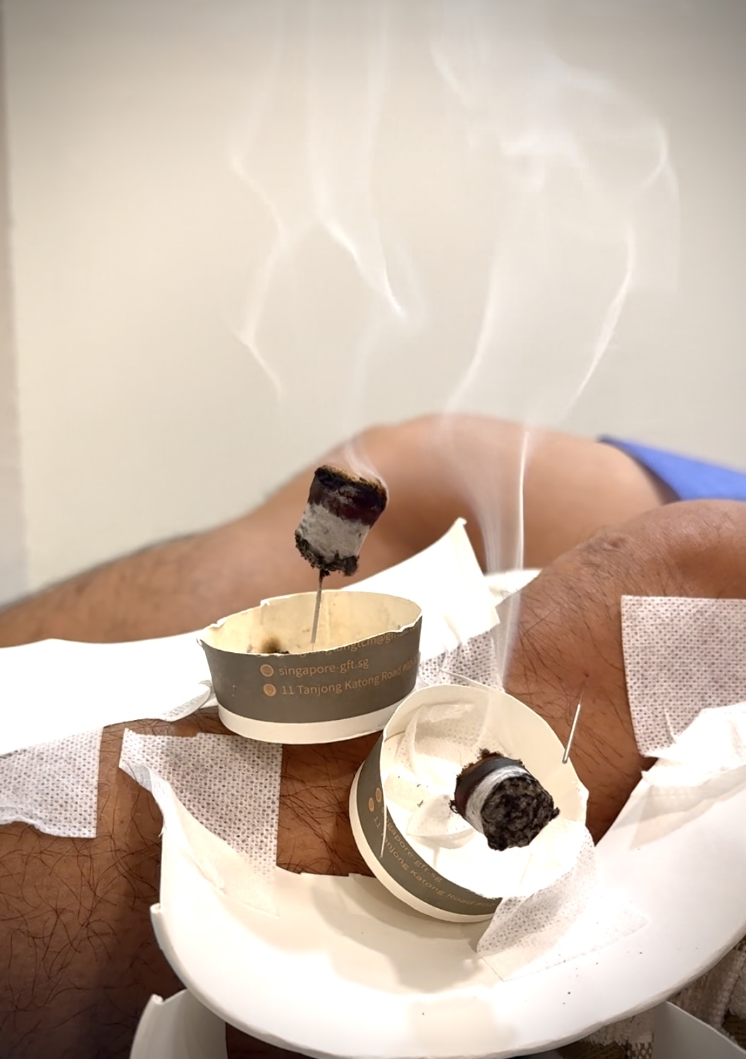 新加坡运动损伤康复中心——贡方堂TCM!